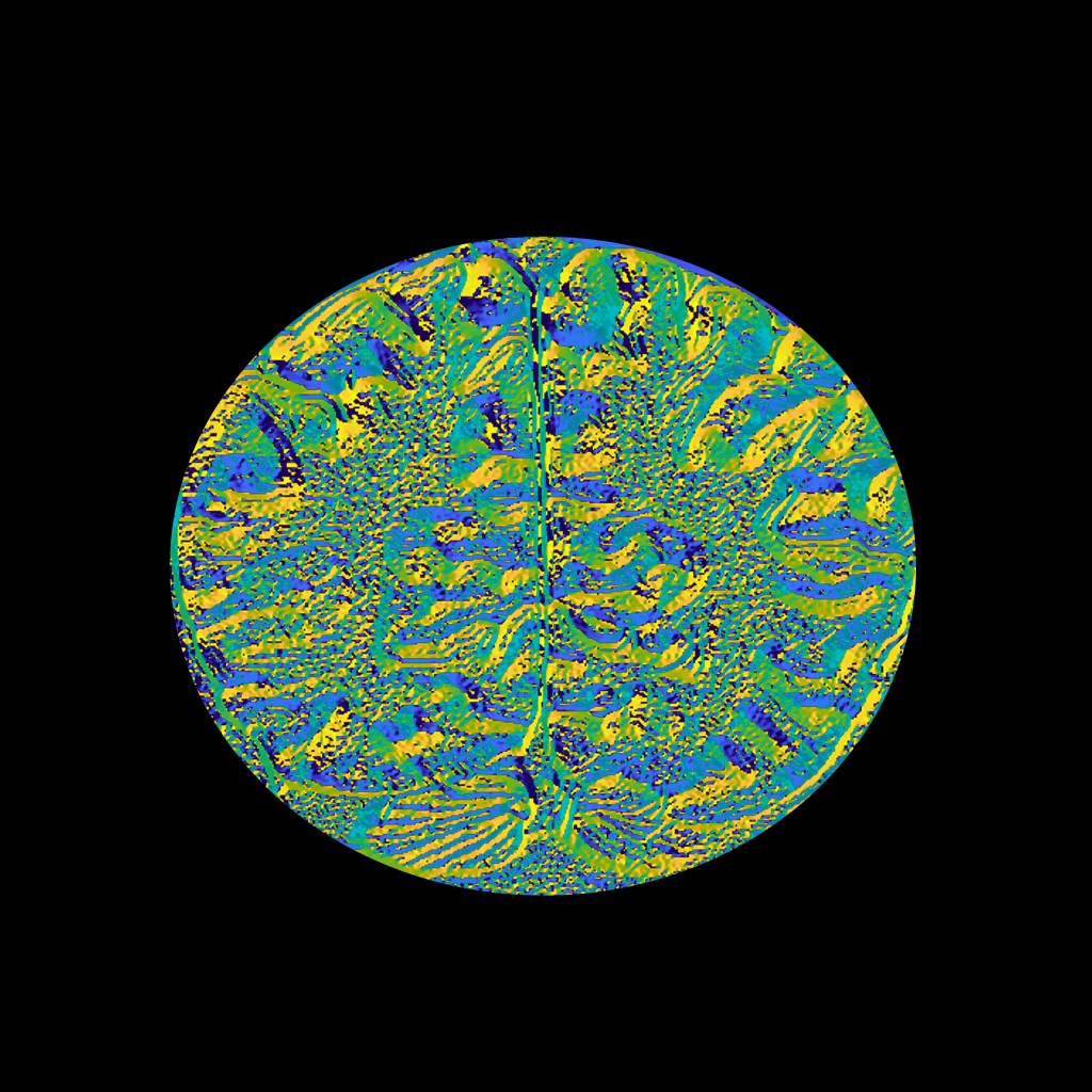 The edge detection filter was used to focus on the area around the cerebellum and the gradient was emphasized. 