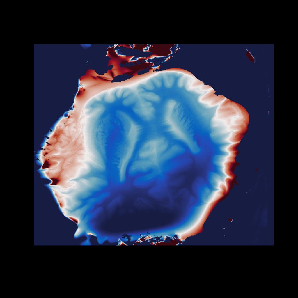 A slice of a whale brain, both human like and... not.