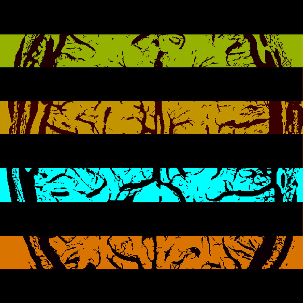 A SWI image put through a vessel detection algorithm, and sliced. 